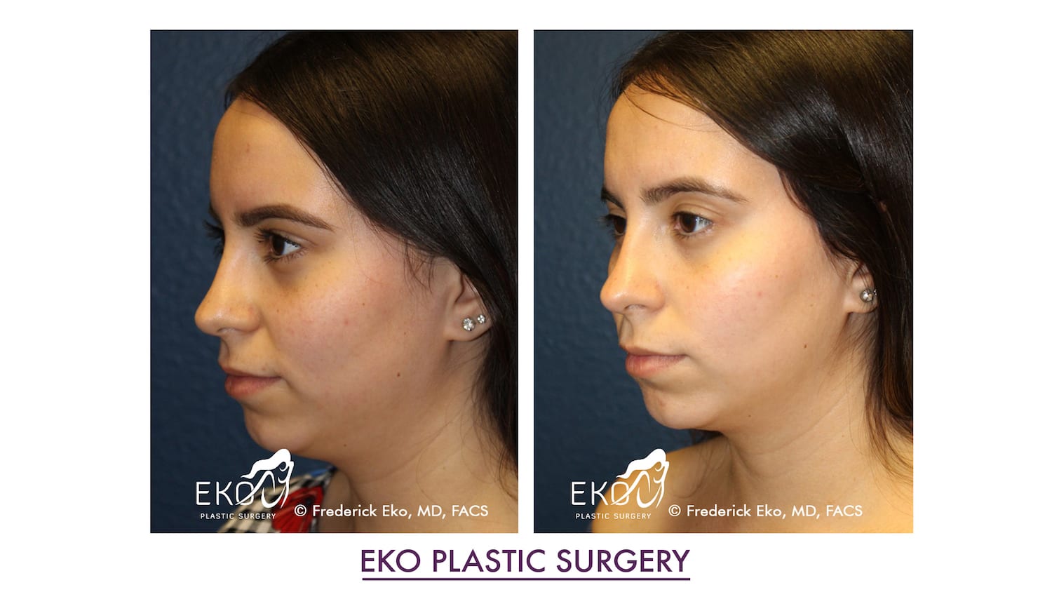 PLASTİK SÜRGÜ - EKO